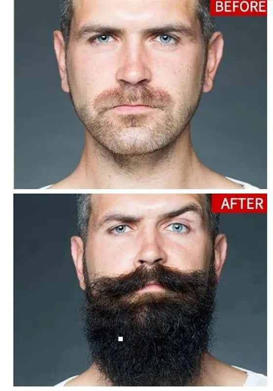 Magic Touch Beard Growth Oil for Men