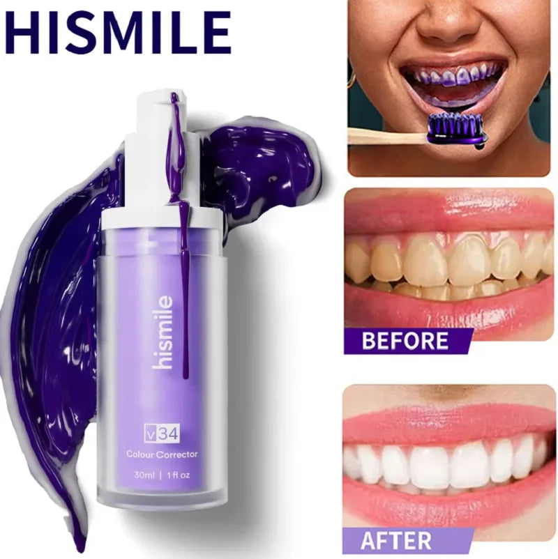 Hismile V34 Tooth Serum