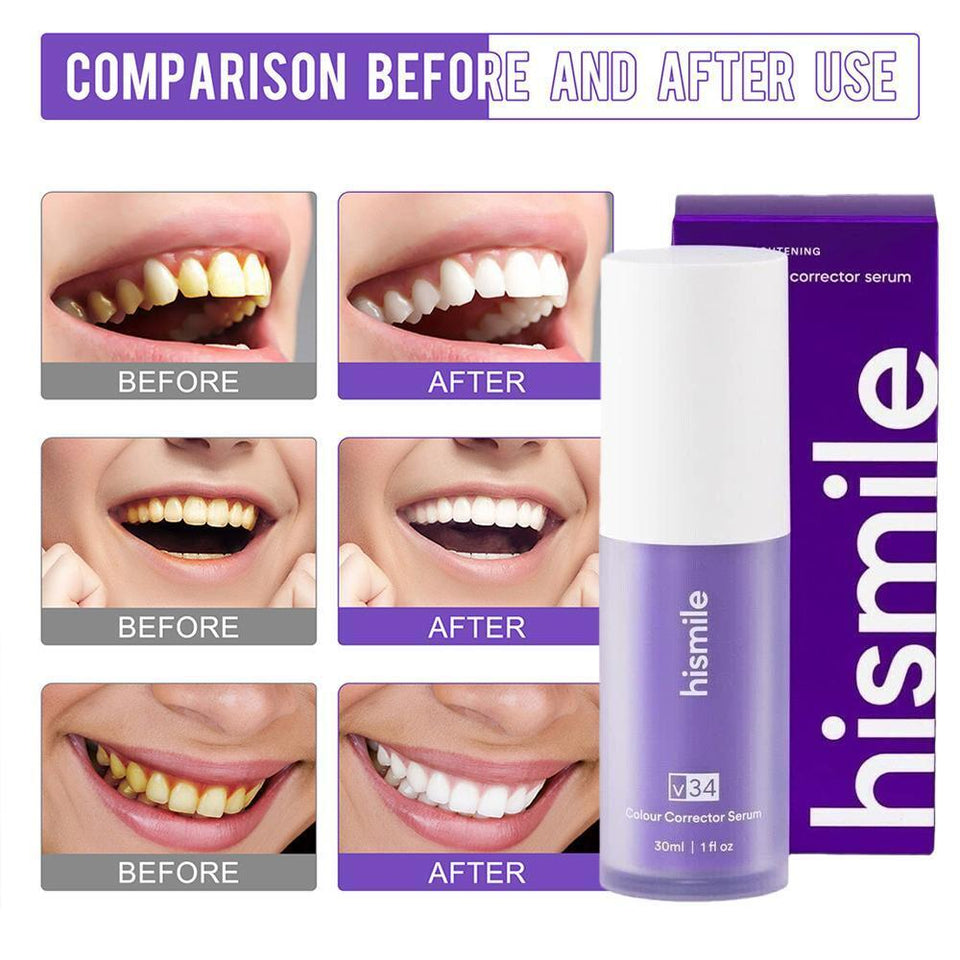 Hismile V34 Tooth Serum