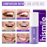 Hismile V34 Tooth Serum